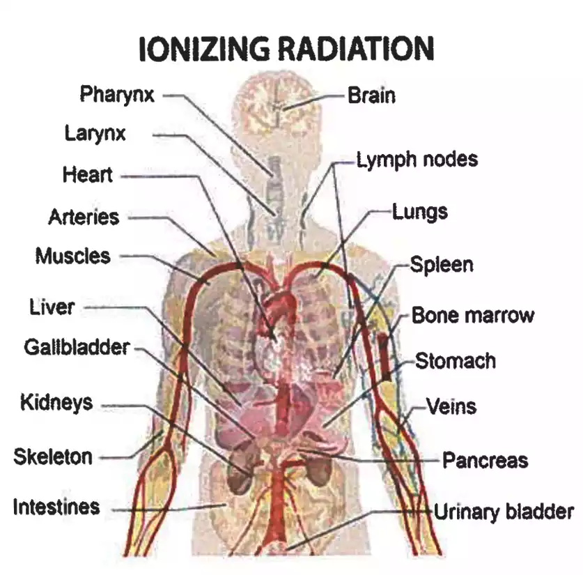 Radiation Related Conditions