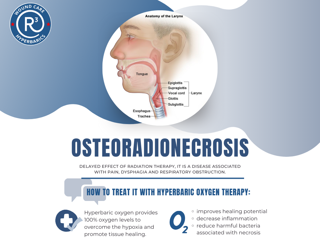 healing story of Osteoradionecrosis