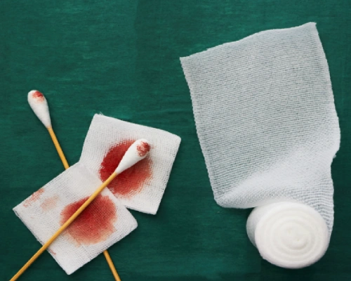 Advanced Wound Dressings
