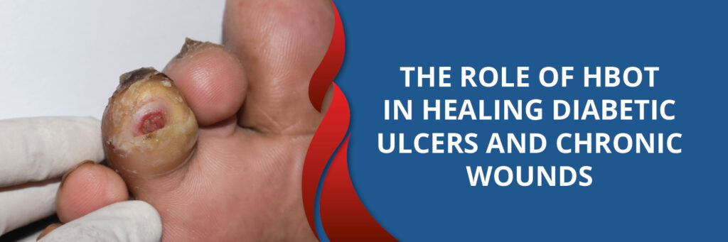 Diabetic Ulcers