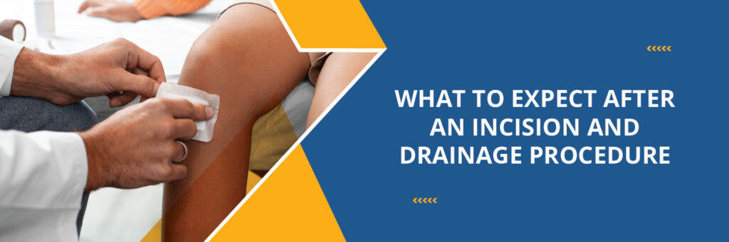 Incision and Drainage Procedure